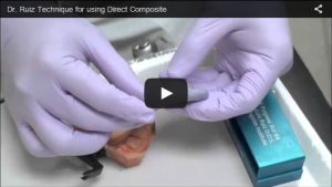 dr-ruiz-technique-for-using-direct-composite