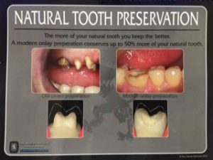 Dental Flip Chart